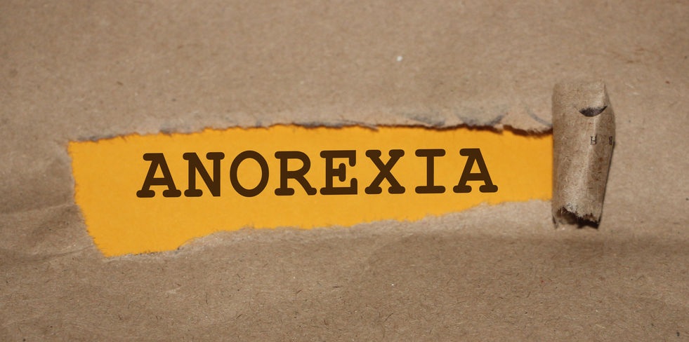 Anorexia Nervosa